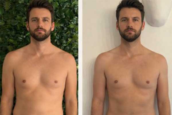 Exemple perte de poids